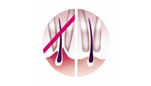 Gentle tweezing discs remove hair without pulling the skin