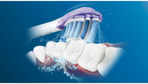 Philips Sonicare -hammasharjan edistynyt Sonic-tekniikka