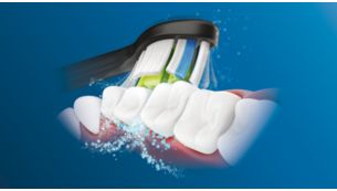 Philips Sonicare -hammasharjan edistynyt Sonic-tekniikka