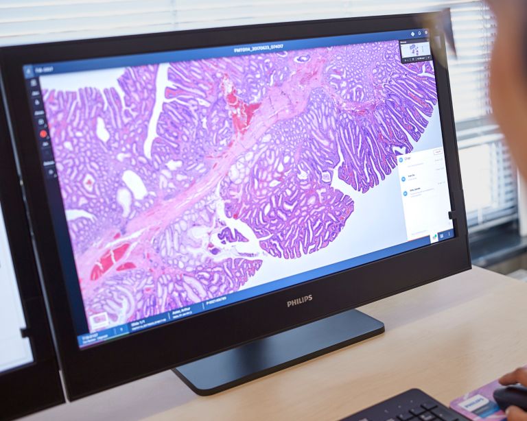 Digital pathology