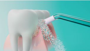 Tehnologie Quadstream: îndepărtează placa bacteriană de sub linia gingivală
